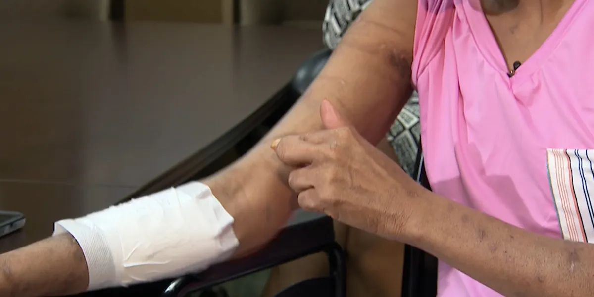 Dog Mauling in Harvey Leaves Woman Severely Injured, Foot Amputated