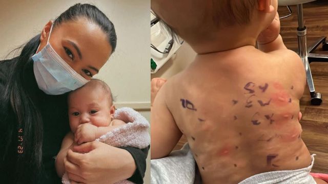 Mom Sparks Debate for Teaching 2-Year-Old to Use Life-Saving EpiPen