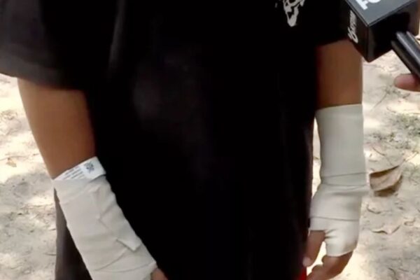 Sixth graders hurt after coach’s challenge on 140-degree track in Texas, Coach resigns